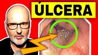 HOW TO CURE GASTRIC and DUODENAL ULCER CAUSES