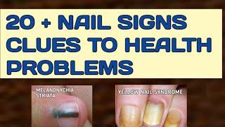 Nail Diseases and Disorders Nail Signs Clues To Health Problems In Children