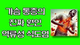 가슴 통증의 진짜 원인 역류성 식도염과 그 치료법