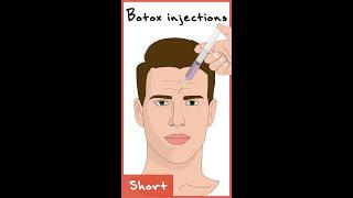 Botox Injections Explained  #shorts