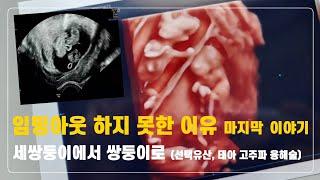 임밍아웃 하지 못한 이유 세쌍둥이에서 쌍둥이로 2편 선택유산 선유 태아 고주파 융해술