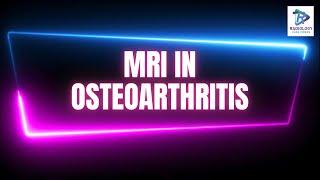 MRI in Osteoarthritis Knee explained.in 1 min # Dr. Uma Maheswara Reddy.V