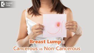 Breast LumpsCancerous vs Non-Cancerous Are all lumps dangerous?-Dr.Nanda Rajneesh Doctors Circle