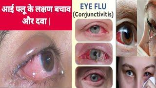 आंख आने के लक्षण बचाव और होम्योपैथिक दवा  Eye Flu  Conjunctivitis Best Homoeopathic Medicine
