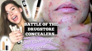 THE BEST ACNE COVERAGE CONCEALER IN THE DRUGSTORE the winner is...  NYX Elf Essence Covergirl