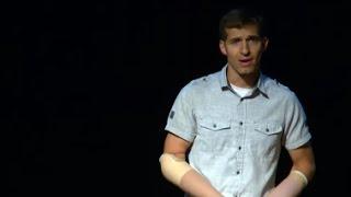 Finding a way to do more with less  Brad Hurtig  TEDxYearlingRoad