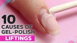 10 Causes of Gel Polish Peeling   Gel Lifting in the Cuticle Zone