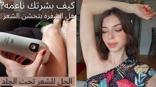 نتائج براون بعد ٦ شهور، ومقارنه الليزر المنزلي والعيادات.braun silk expert pro 5