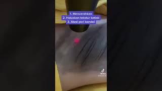 Laser ketiak hitam biar cerah kembali di AISKIN