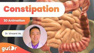 Constipation  The GutDr Explains 3D Gut Animation