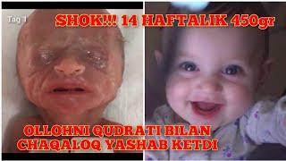 OLLOHNI QUDRATI BILAN 14 HAFTALIK 450gr TUG‘ILGAN QIZALOQ YASHAB KETDI...MASHALLAX 14 week born..