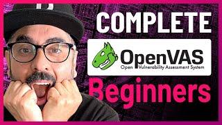 Complete Beginner OpenVAS Vulnerability Scanning Tutorial - Cyber Security  Kali Linux