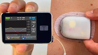 Omnipod 5 vs Tandem tslim x2  Full Test & Review