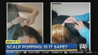 Scalp popping - the newest trend