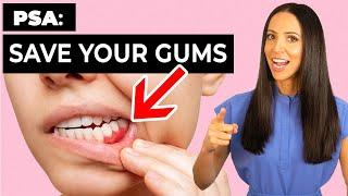 These 4 Things Can SAVE Your GUMS You Still Have Time