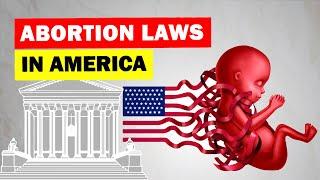 Full History of Abortion Rights and Laws in America