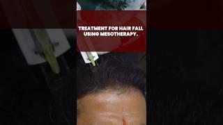 Treatment for hair fall using Mesotherapy  Hair treatment  HairMD Pune