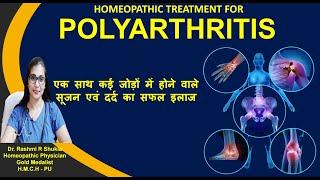 एक साथ कई हड्डियोंजोड़ों में हो दर्द तो जरूर देखें ये वीडियो Polyarthritis Treatment in Homeopathy