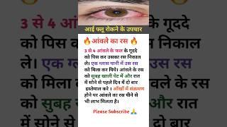 आई फ्लू को रोकने के उपाय -4 #shorts #health #healthy #ayurveda #eyeflu