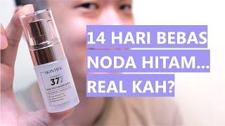 HEMPAS FLEK HITAM? Skintific SymWhite 377 Dark Spot Eraser Serum  14 Hari Auto Cerah?