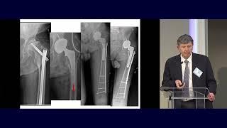 22  Proximal Femur   Emil Schemitsch MD