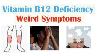 Vitamin B12 Deficiency Weird Symptoms & Why They Occur