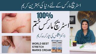 STRETCH MARKS REMOVER  ANTI STRETCH MARKS CREAM  BY DR. BILQUIS SHAIKH