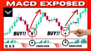 Ultimate MACD Indicator Trading Course EXPERT INSTANTLY