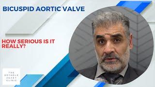 Bicuspid Aortic Valve How Serious Is It Really?