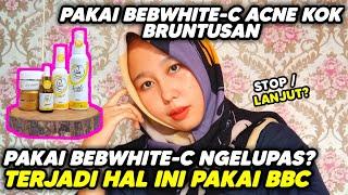 Pakai Skincare Beb White C Acne Makin bruntusan? BBC ngelupas?