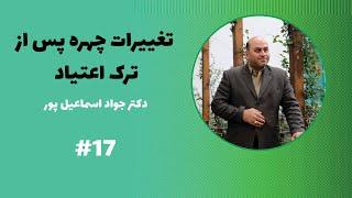 تغییرات چهره پس از ترک اعتیاد - پادکست شماره هفده