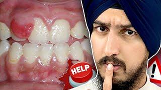 7 Reasons You Have SWOLLEN Gums And How To Fix It