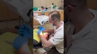  Рятуємо усмішку пацієнта - робимо реставрацію на скловолоконному штифті. #стоматологія #зуби