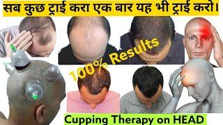 Cupping Therapy on Head with 100% results #Alopecia गंजेपन से छुटकारा #khujli #fungal #infection