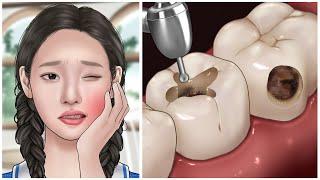 ASMR My teeth hurt so much cavities treatment animation