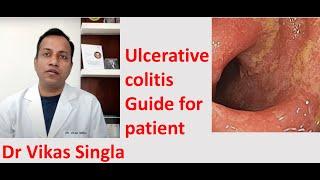 Ulcerative colitis  Treatment and Symptoms अल्सरेटिव कोलाइटिस In Hindi Dr Vikas Singla