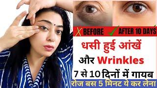 धसी हुई आंखें  Dark Circle और Wrinkles को 3 से7 दिनों में गायब करने का रामबाण घरेलू उपाय#Darkcircle