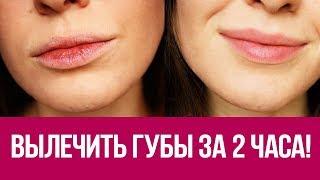  Как быстро восстановить губы? Экспресс вариант за 2 часа 