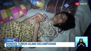 Ironis Kisah Gadis Lumpuh di Mojokerto 2 Tahun Hanya Terbaring di Tempat Tidur - SIS 1302