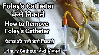 How to remove foleys Catheter  Foleys Catheter कैसे निकाले  Urinary Catheter Remove कैसे करें