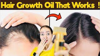 Ayurvedic Secret To Stop Hair fall & Regrow New Hair  आयुर्वेदिक  Hair Oil️