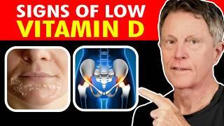 Top 7 Signs Your Vitamin D Is Low