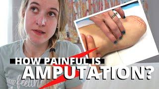 How BAD Does AMPUTATION Hurt??