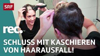 Haarausfall bei Frauen – Von Vorurteilen Schamgefühl und Weiblichkeit  Reportage  rec.  SRF