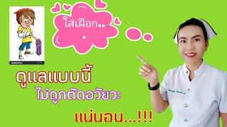 #แขนหักใส่เฝือกแขน #ใส่เฝือกดูแลยังไง ใส่เฝือกดูแลยังไงไม่ถูกตัดแขน