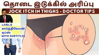 தொடை இடுக்கில் அரிப்பு நீங்க  jock itch dark skin spots black patches removal home remedies karthik