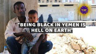 Black Yemenis Face Racism Because Theyre Not Seen As Arabs