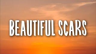 Maximillian - Beautiful Scars Lyrics