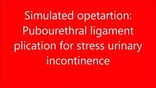 Pubourethral plication  simulated operation for stress urinary incontinence