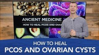 How to Treat PCOS and Ovarian Cysts Naturally  Dr. Josh Axe